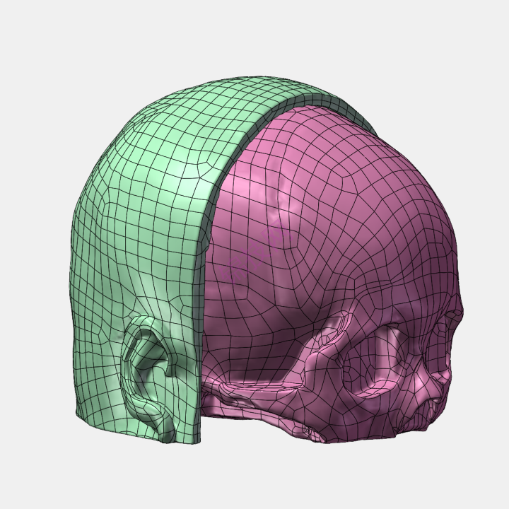 颅骨和头皮模型下载stp文件